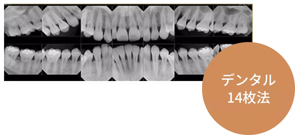 デンタル14枚法
