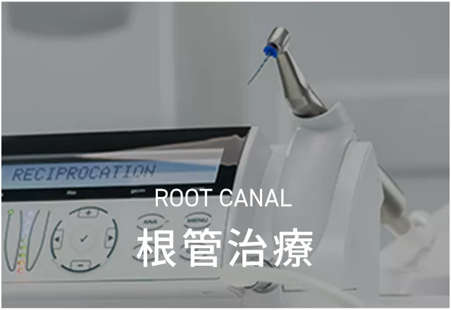 root canal