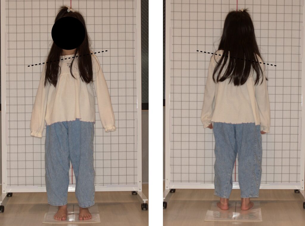 姿勢が歪んでいる写真