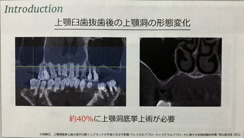 ICEEDのセミナー