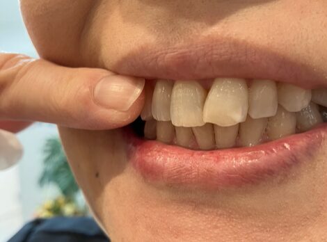 フレミタスの確認方法