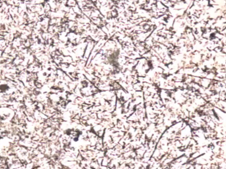 歯周病菌の顕微鏡画像