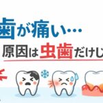 歯が痛い原因は虫歯だけじゃない