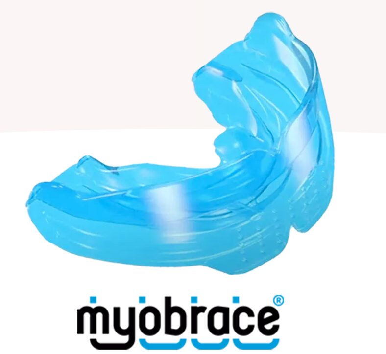 マイオブレースの写真