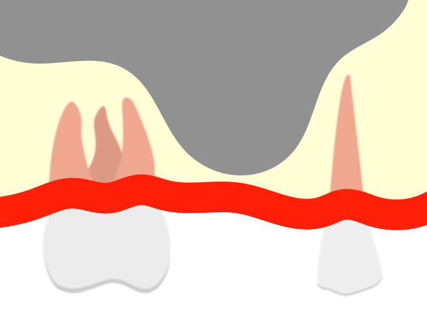 既存骨が少ないイラスト