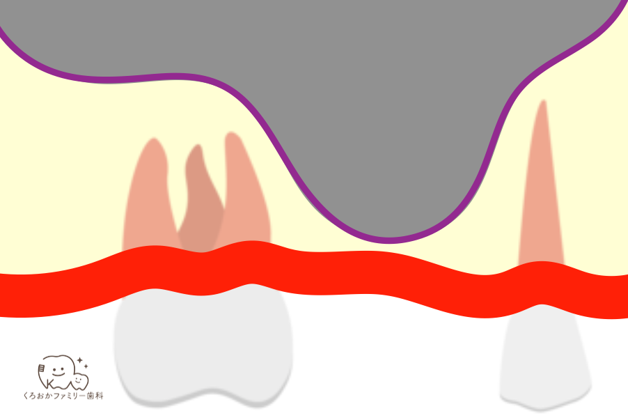 シュナイダー膜のイラスト