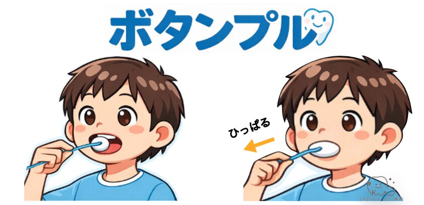 ボタンプルのイラスト