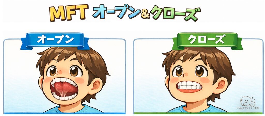 MFTオープンアンドクローズのイラスト