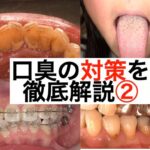 口臭の対策を徹底解説②