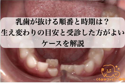 乳歯が抜ける順番と時期は?生え変わりの目安と受診した方がよいケースを解説
